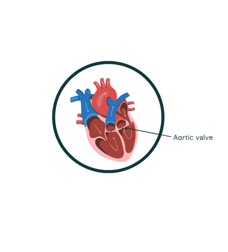 Aortic Valve