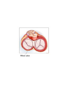 Mitral Valves